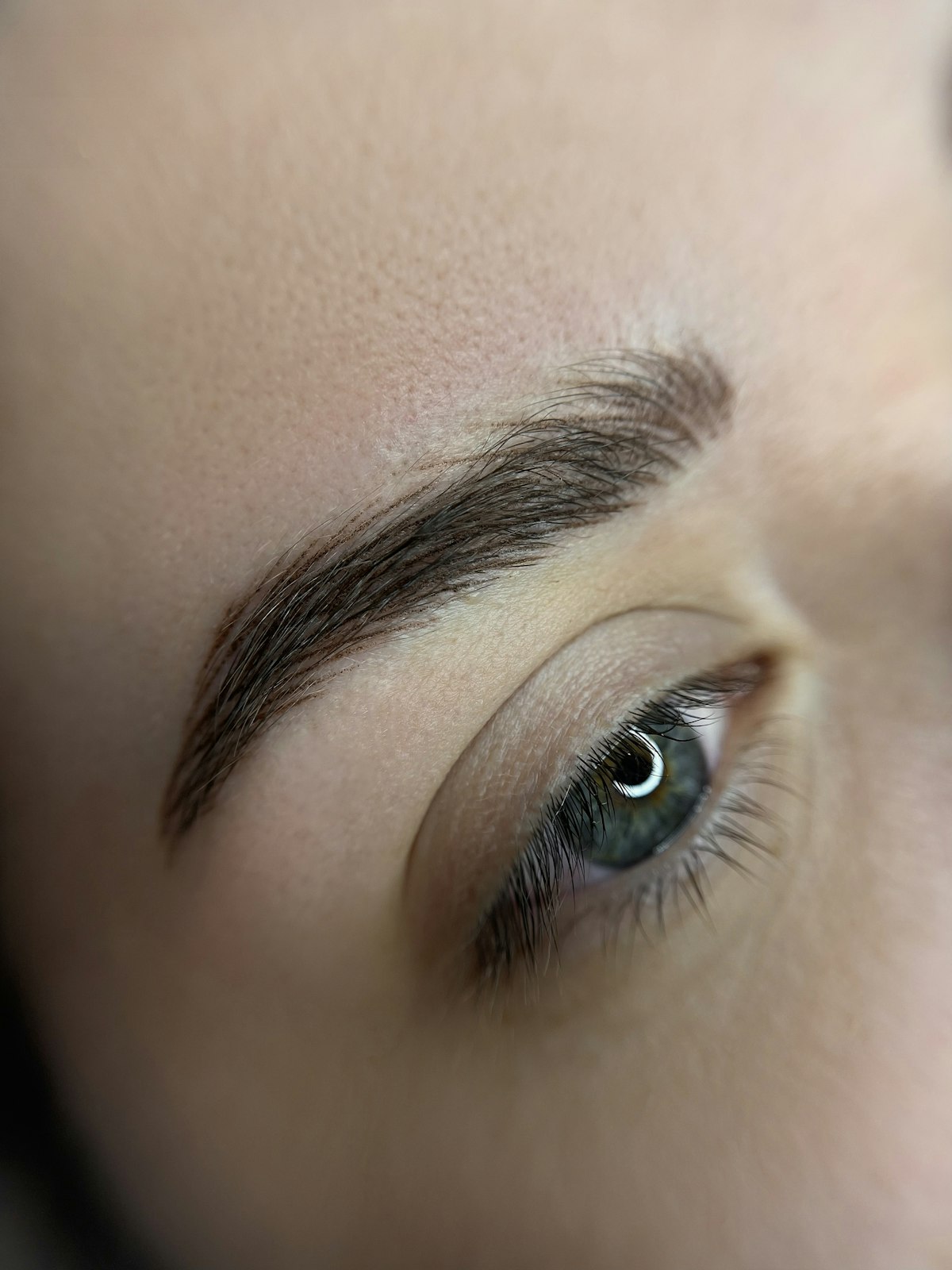Forehead Lift — illustrative image