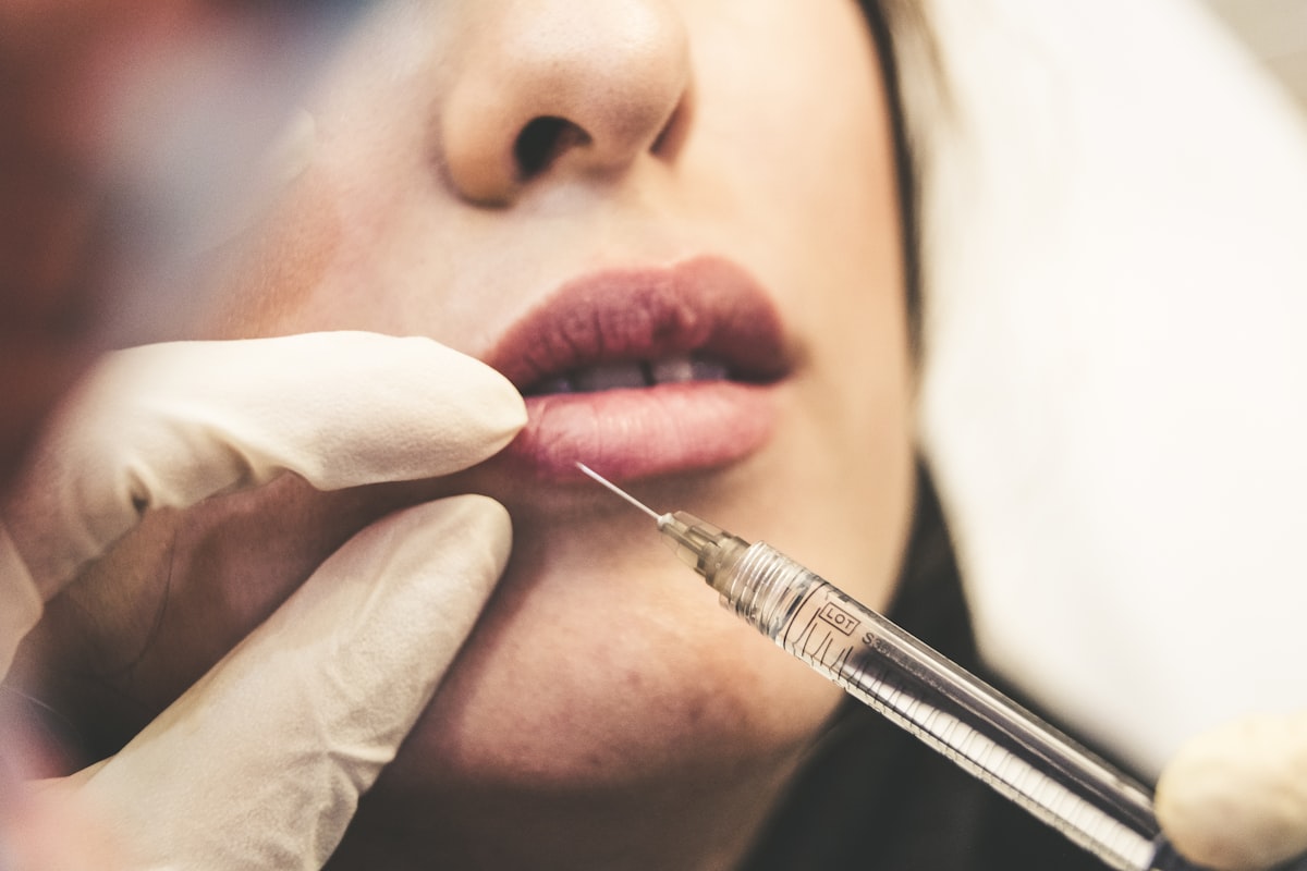 Lip Augmentation — illustrative image