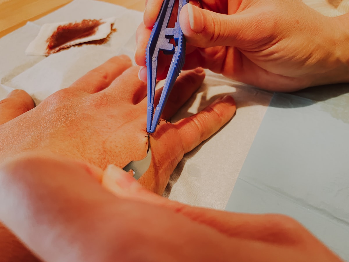 Nail Deformities — illustrative image
